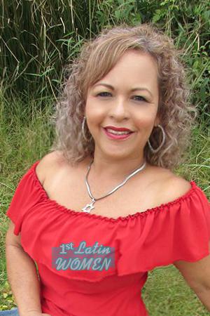 171215 - Carmen Age: 65 - Costa Rica