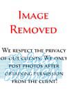 img-removed-lg